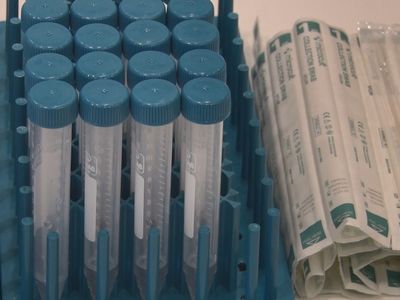Türk Bilim İnsanları, Koronavirüsü 10 Saniyede Tanıyan Kit Geliştirdi