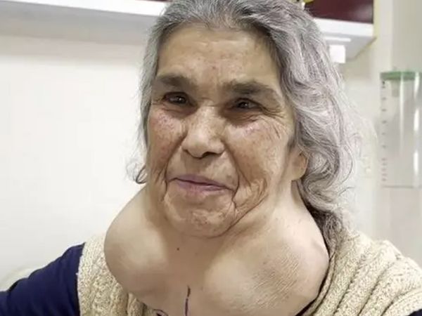 Boynunu gören uzmanlar dondu kaldı: Denizli'de ilginç olay! Doktor korkusuyla hastaneye gitmeyince...