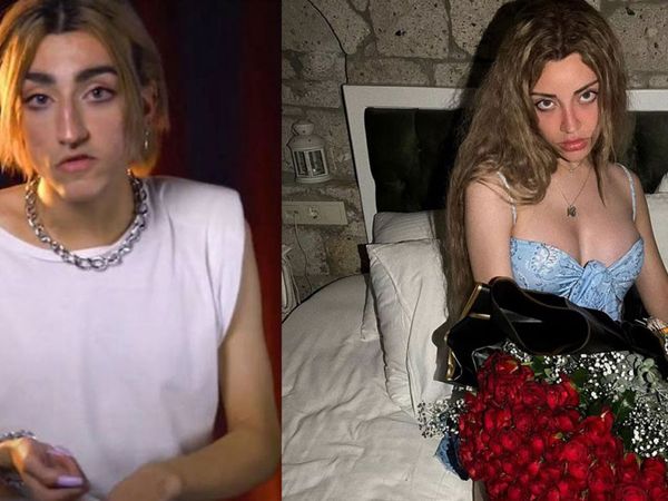 Cinsiyet değiştiren Mika Raun’dan şok eden sözler! Göğüslerini yaptırdıktan sonra fiyatları arttırdı ‘Bir cinsel ilişki...’