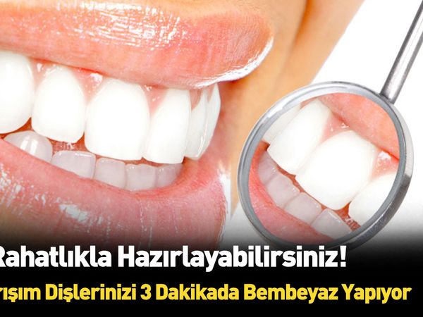 Dişleri 3 dakikada bembeyaz yapan formül