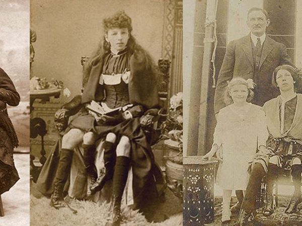 Dört bacak ve iki rahimle doğan kadın Myrtle Corbin'nin hayat hikayesi
