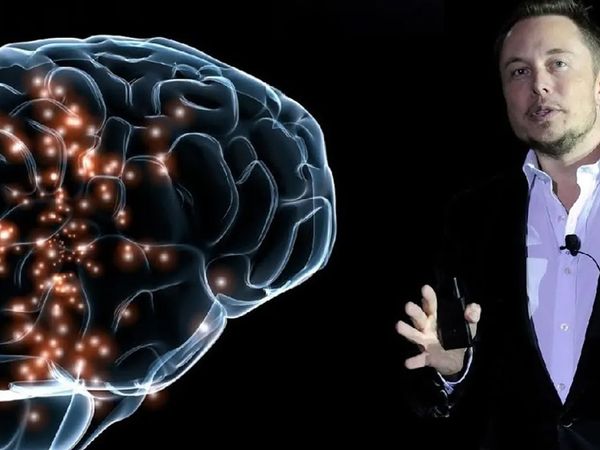 Dünyada ilk kez bir insanın beynine çip takmıştı! Son gelişmeleri açıkladı: Şok olacaksınız!