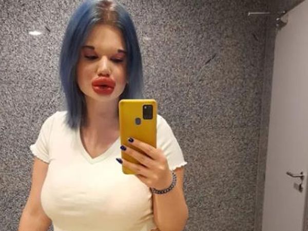 Dünyanın En Büyük Dudaklı Kadını