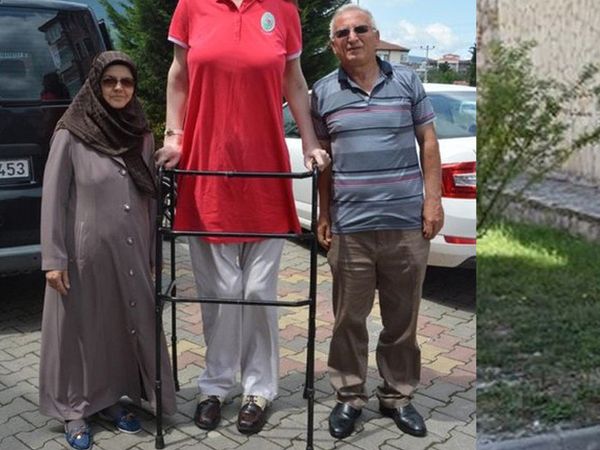 Dünyanın en uzun kadını Rümeysa 3. kez rekorlar kitabına girdi!
