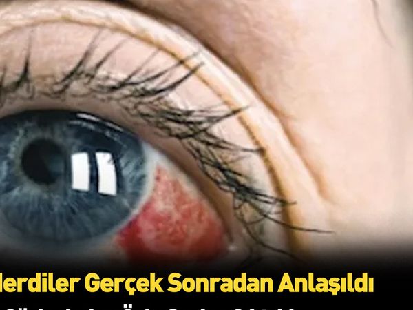 Egzama dediler kasık biti çıktı: Küçük çocuğın başına gelmeyen kalmadı!