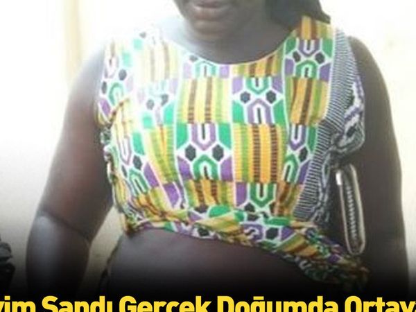 Güney Afrika'da eşi benzeri olmayan doğum olayı