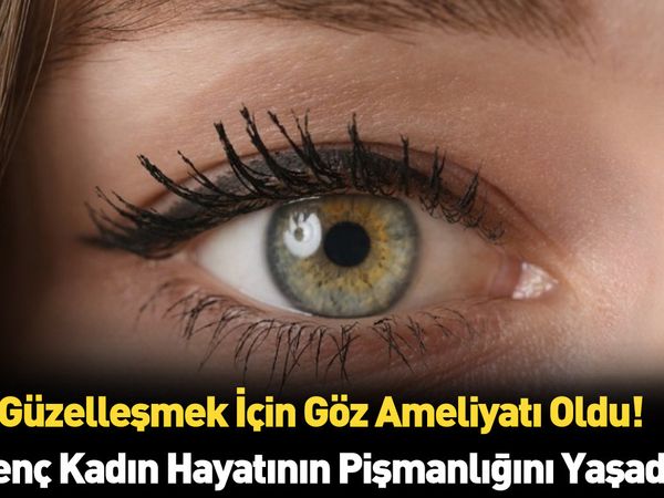 Güzel gözlere sahip olmak istedi ama felaketi yaşadı gözlerine bakanlar korkuyor