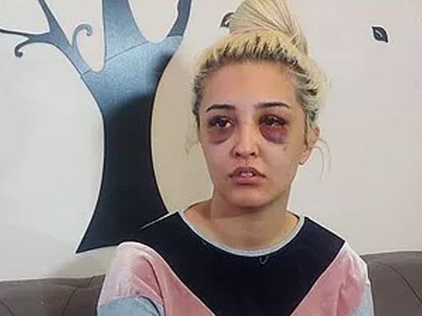 İzmir’de korkunç olay! Gamze Tümtürk’ün sevgilisi önce dövdü sonra uyumak istedi