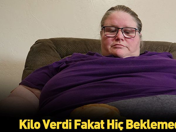 Kilo verdikten sonraki hali görenleri şoke ediyor!
