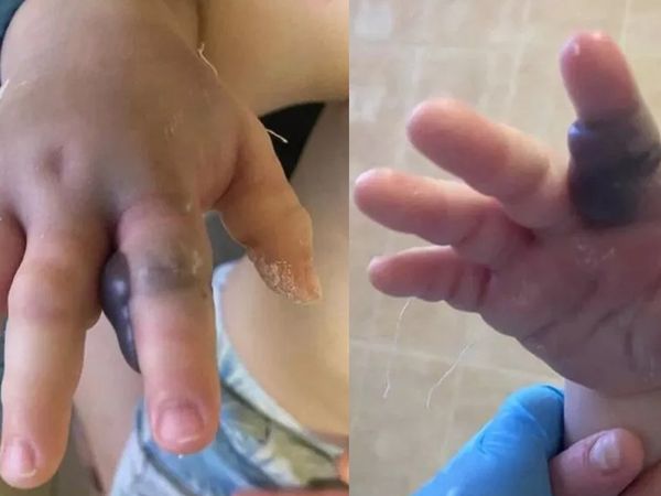 Küçük bebek engerek yılanının kurbanı oldu! Annesi fark edene kadar zehir yayıldı bebeğin son halini görenler inanamadı