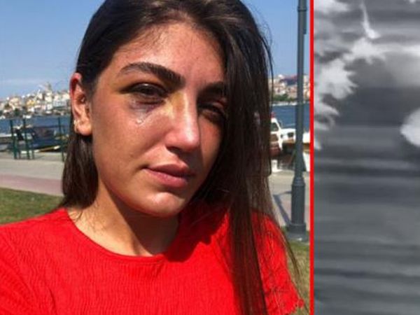 Manken Gizem Akbaş Eski Sevgilisi Tarafından Darp Edildi
