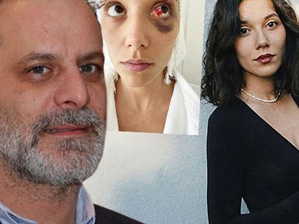 Ozan Güven'in eski sevgilisi Deniz Bulutsuz'u darp ettiği davada son gelişme: Adli Tıp Kurumu raporu hazırladı