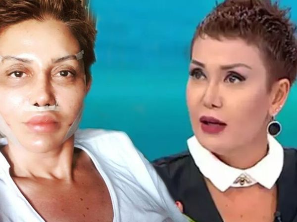 Seda Sayan’ın estetik doktoruna giden Serap Paköz değişimiyle herkesi şaşırttı! Kimse tanıyamıyor
