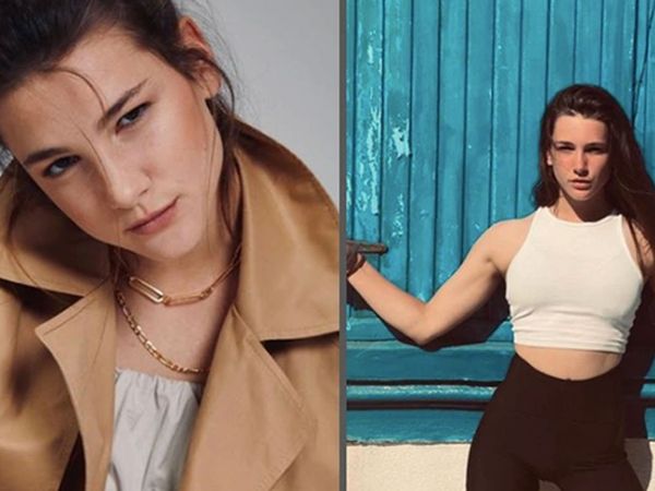 Survivor Nisa estetik kurbanı oldu! Seda Sayan'ın izinden gidiyor! Son haline yorum yağdı 'Nasıl kıydın doğallığına?'
