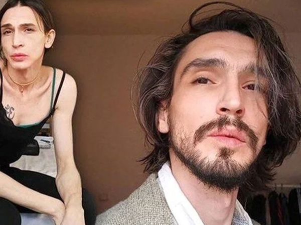 Trans birey Ahmet Melih Yılmaz kadın olduktan sonra minicik eteği ile dans şovu yaptı