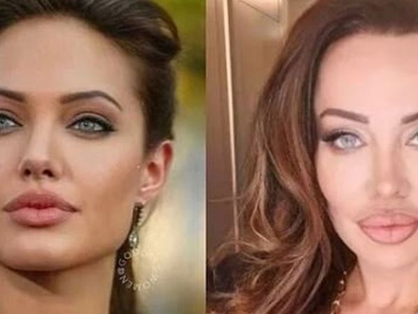 Yerli Adriana Lima Umut Akyürek güzelleşmek için yüzüne sülük yapıştırdı bin pişman olan Akyürek'in o hali herkese ders oldu