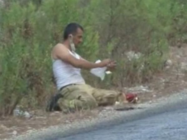 Antalya’da Çıkan Yangında Orman İşçisi Kendi Yarasını Sarıp İşine Devam Etti