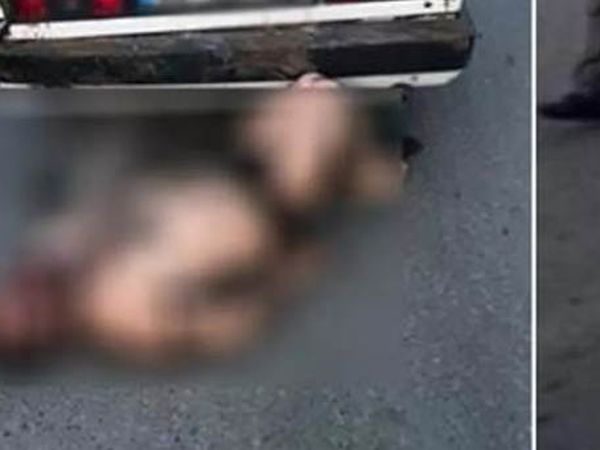 Rize'de Darbedilen Kişi Bagajdan Çıkarılırken Yakalandı!
