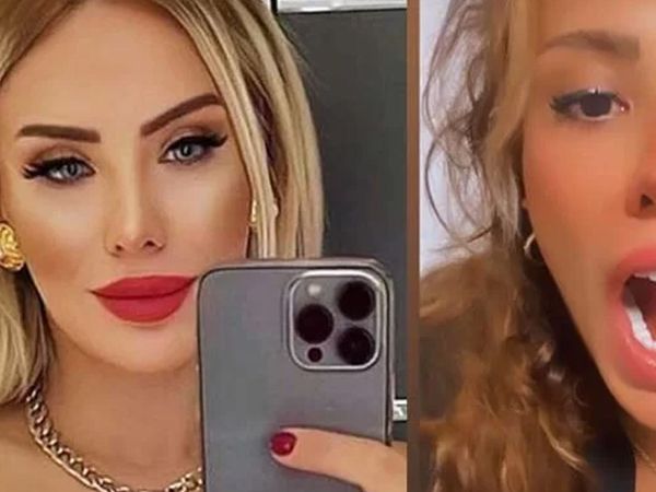 Ceyda Ersoy öpüşürken dilini ısırdı