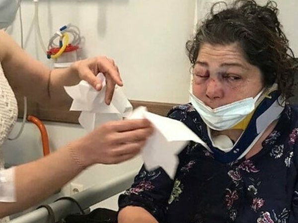 CHP’li Belediye Başkanına Skandal İddia; 'Park Bakımsız’ Diyen Kadını CHP’li Başkanın Korumaları Darp Etti