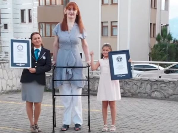 Dünyanın en uzun kadını Rümeysa 3 yeni rekora imza attı