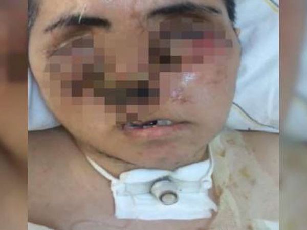 Eniştesinin Saldırısına Uğradı, Tanınamaz Hale Geldi