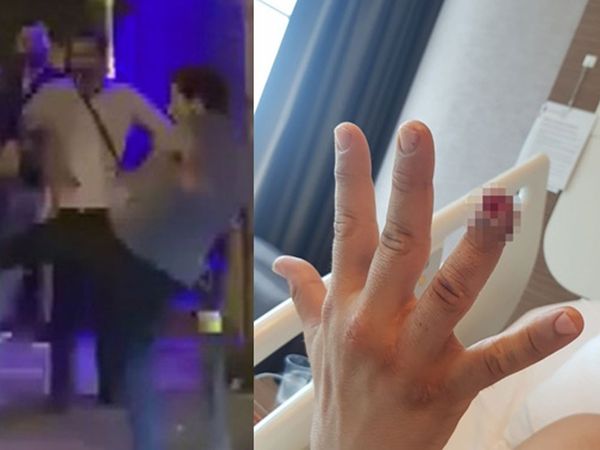 Güvenlik Görevlisinin Parmağını Isırıp Kopardı: 4,5 yıl Hapsi İstendi