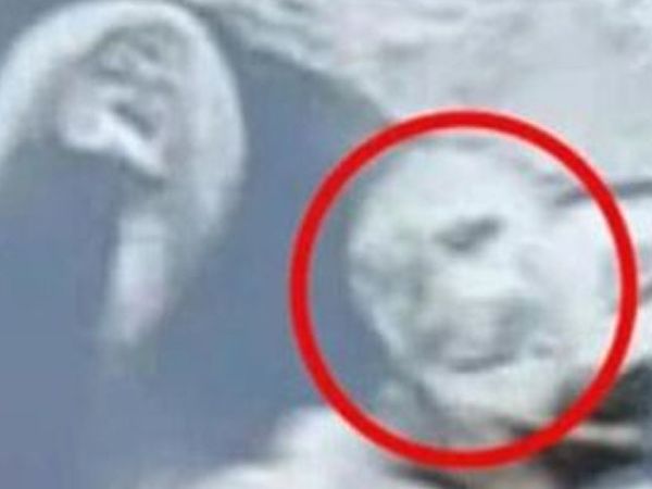 Hamile Kadın Ultrason Fotoğrafında Büyükbabasını Gördü