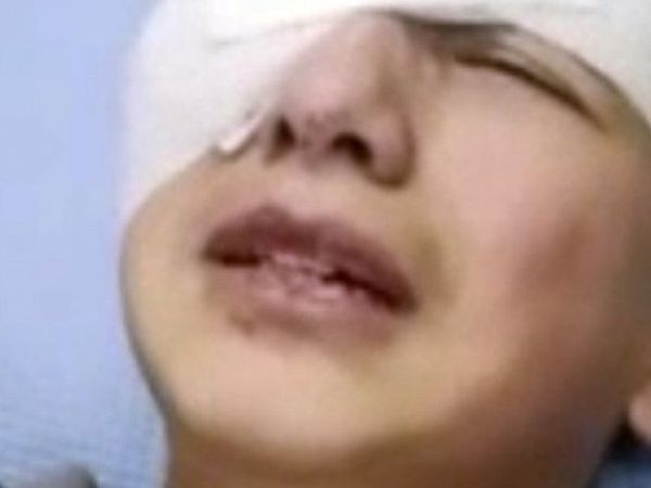 İsrail Güçleri, Filistinli Çocuğu Plastik Mermiyle Gözünden Vurdu