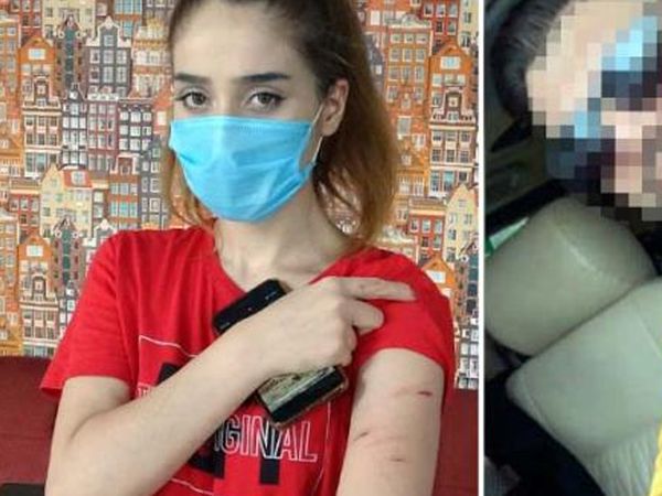 Sultangazi'de 18 Yaşındaki Eski Sevgilisine İşkence Uygulayan Erkek Serbest Bırakıldı