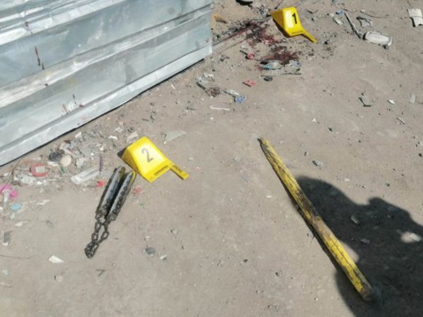 Kayseri’de Kavga Ettiği Şahsa Av Tüfeği ile Ateş Açtı