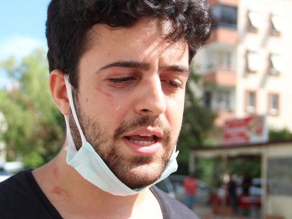 Köpeklerini Gezdiren Genç Sokak Ortasında Saldırıya Uğradı