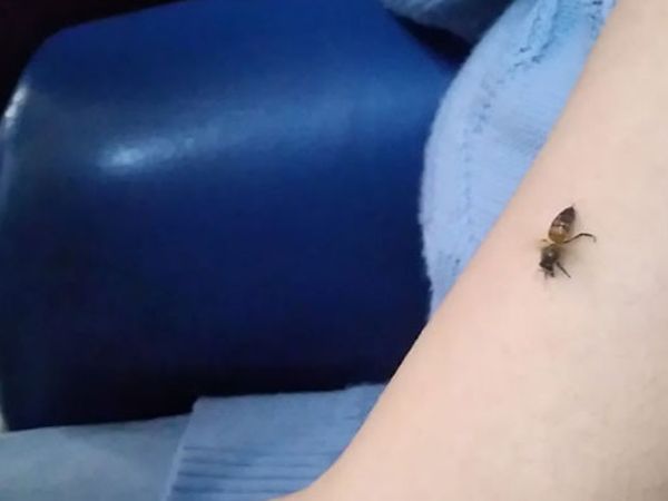 Kovid-19'a İyi Geldiğini Öne Sürerek Kendilerini Arılara Isırtıyorlar