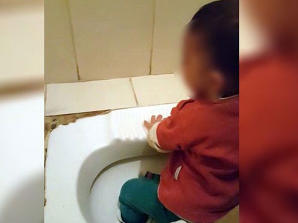 Küçük Çocuğun Ayağı Tuvalet Deliğine Sıkıştı