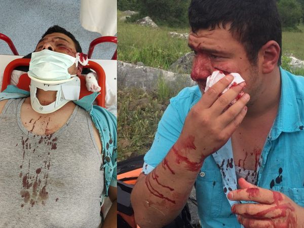 Kurduğu Kaçak Yapılarla Anılan Lütfü Türkkan’ın Adamlarından İHA Muhabirine Kanlı Saldırı Geldi