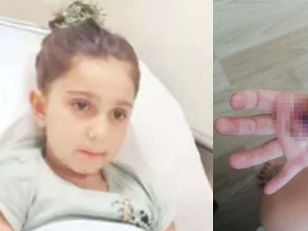 MR çekilen küçük kız yandı! Soluğu adliyede aldılar