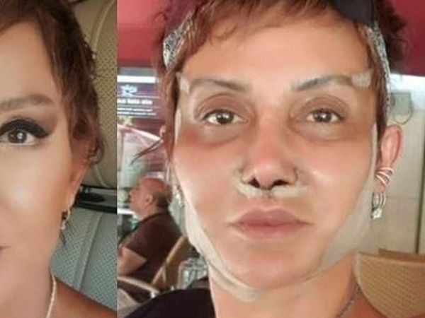 Serap Paköz Estetikleri ile Çok Şaşırttı!