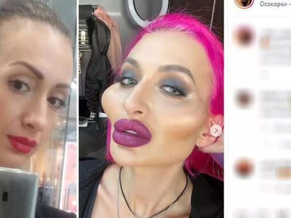 Ukraynalı modelden estetik terörü: Duru güzelliğini öyle bir hale getirdi ki! Artık korku filmlerinde oynayabilir...