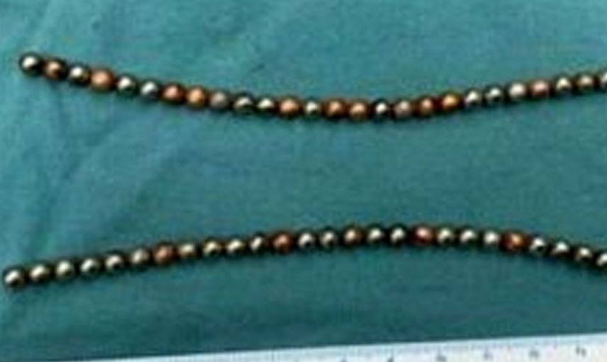 Türlü sex oyuncakları yüzünden sonu hastanelik olan insanlar