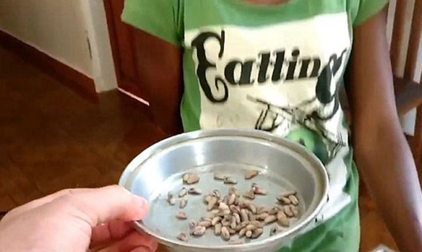 Veteriner köpeğin derisinden yüzlerce canlı kurdu tek hamlede çıkardı!