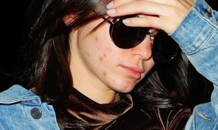 Kendall Jenner'i Makyajsız Görenler Tanıyamadı!