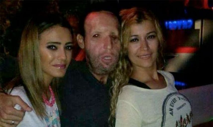 Recep Sert Çok Zor Durumda!