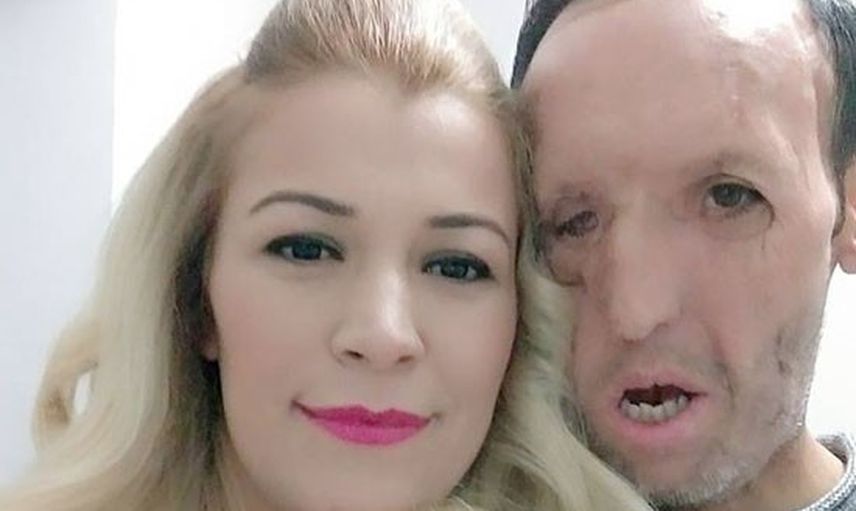 Recep Sert Çok Zor Durumda!