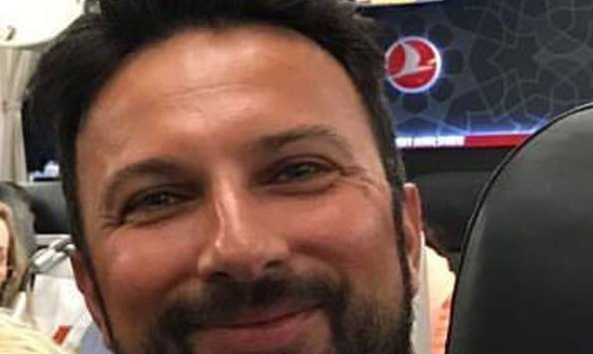 Tarkan Estetik Yaptırdı! İşte Son Hali...