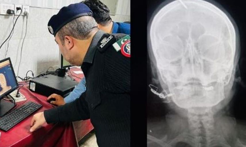 Erkek çocuğu için öyle bir şey yaptı ki doktorlar ayaklandı