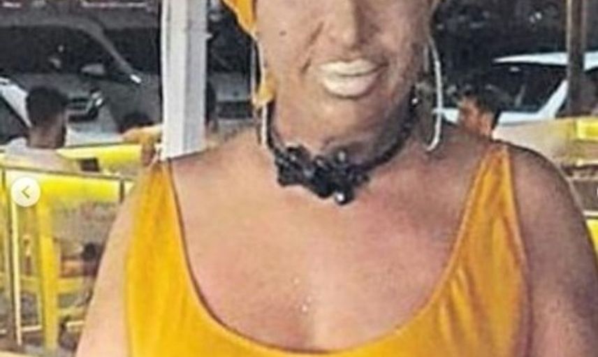 İzmir'de Bülent Ersoy'a Benzemek İçin 5 Yılda 10 Ameliyat Olan Suat Su