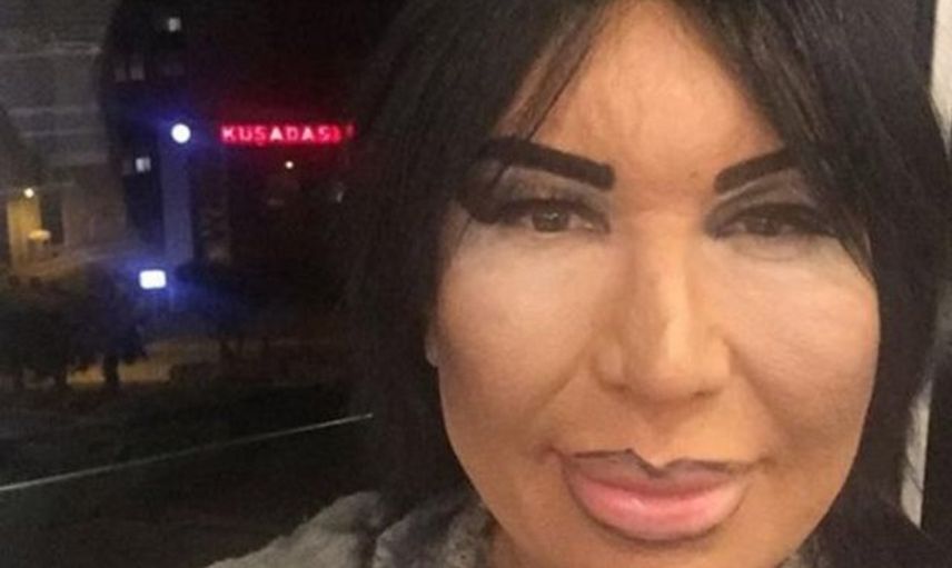 İzmir'de Bülent Ersoy'a Benzemek İçin 5 Yılda 10 Ameliyat Olan Suat Su