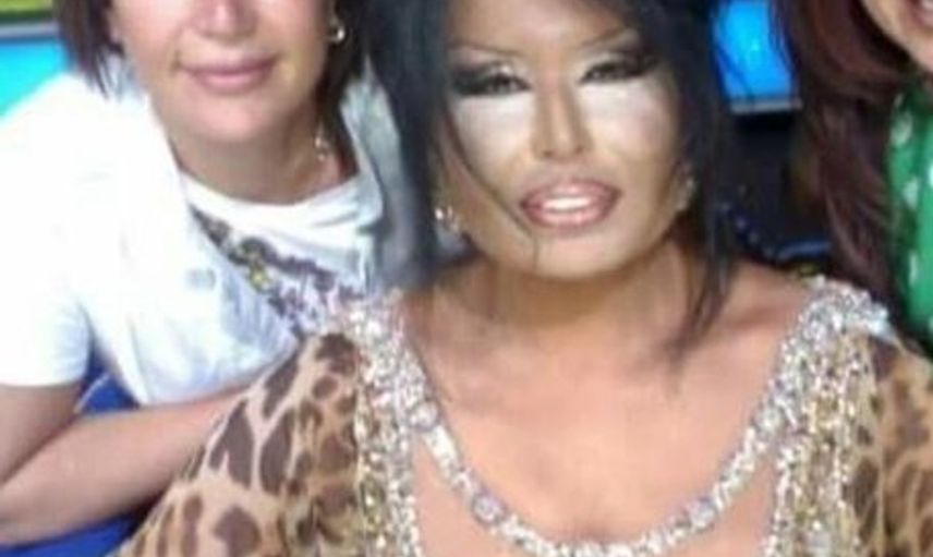 İzmir'de Bülent Ersoy'a Benzemek İçin 5 Yılda 10 Ameliyat Olan Suat Su