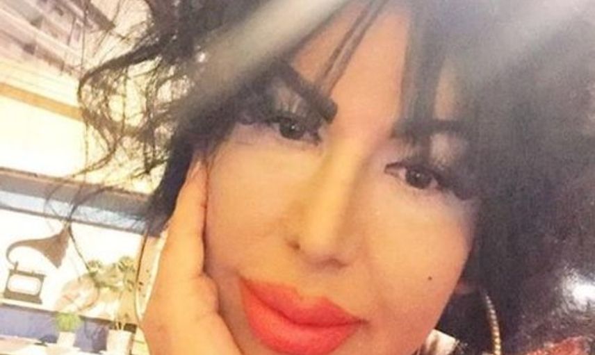İzmir'de Bülent Ersoy'a Benzemek İçin 5 Yılda 10 Ameliyat Olan Suat Su