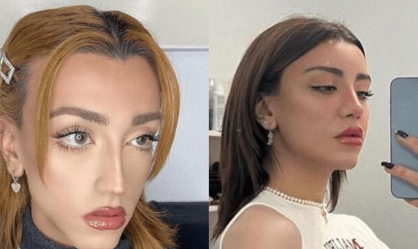 Mika Raun mini eteği uzun sarı saçları ile salındı ortalık yıkıldı